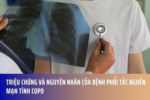 Triệu chứng và nguyên nhân của bệnh phổi tắc nghẽn mạn tính COPD