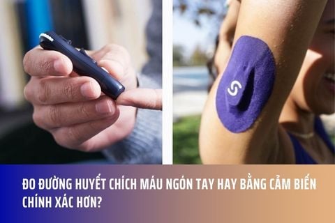 Đo đường huyết chích máu ngón tay hay bằng cảm biến chính xác hơn?