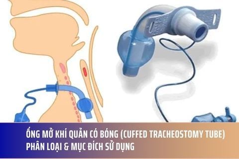 Ống Mở Khí Quản Có Bóng (Cuffed Tracheostomy Tube): Phân Loại & Mục Đích Sử Dụng