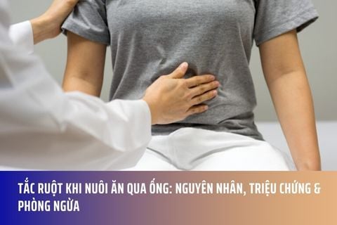 Tắc Ruột Khi Nuôi Ăn Qua Ống: Nguyên Nhân, Triệu Chứng & Phòng Ngừa