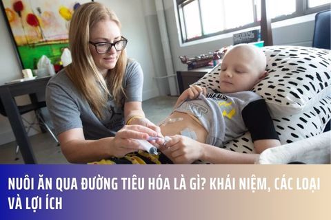 Nuôi ăn qua đường tiêu hóa là gì? Khái niệm, Các loại và Lợi ích