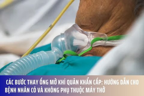 Các Bước Thay Ống Mở Khí Quản Khẩn Cấp: Hướng Dẫn Cho Bệnh Nhân Có và Không Phụ Thuộc Máy Thở