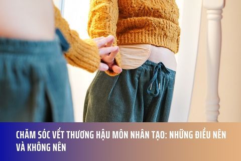 Chăm Sóc Vết Thương Hậu Môn Nhân Tạo: Những Điều Nên và Không Nên