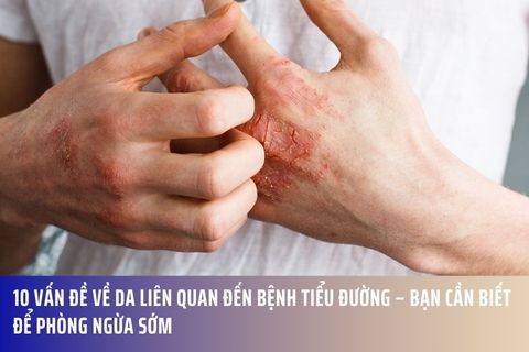 10 Vấn Đề Về Da Liên Quan Đến Bệnh Tiểu Đường – Bạn Cần Biết Để Phòng Ngừa Sớm