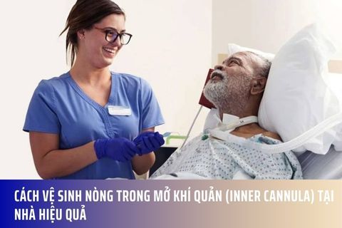 Cách vệ sinh nòng trong mở khí quản (inner cannula) tại nhà hiệu quả
