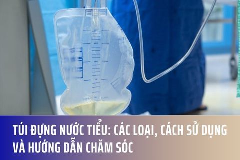 Túi Đựng Nước Tiểu: Các Loại, Cách Sử Dụng và Hướng Dẫn Chăm Sóc
