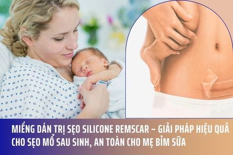 Miếng dán trị sẹo silicone Remscar – Giải pháp hiệu quả cho sẹo mổ sau sinh, an toàn cho mẹ bỉm sữa