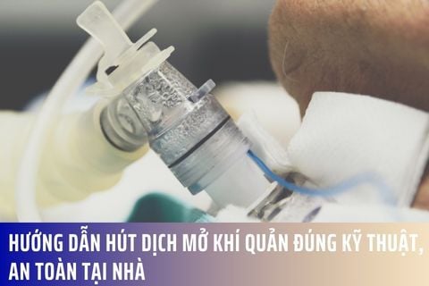 Hướng dẫn hút dịch mở khí quản đúng kỹ thuật, an toàn tại nhà