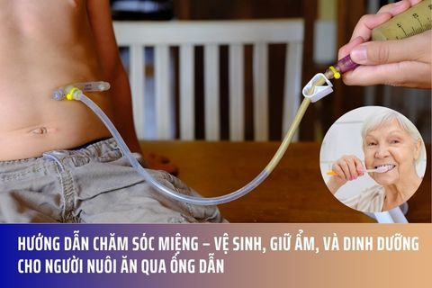 Hướng Dẫn Chăm Sóc Miệng – Vệ Sinh, Giữ Ẩm, Và Dinh Dưỡng Cho Người Nuôi Ăn Qua Ống Dẫn