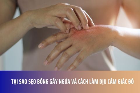 Tại Sao Sẹo Bỏng Gây Ngứa Và Cách Làm Dịu Cảm Giác Đó