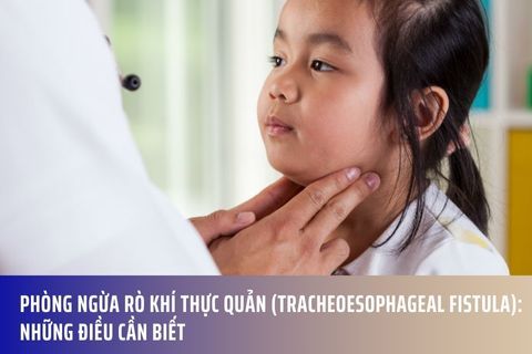 Phòng ngừa rò khí thực quản (tracheoesophageal fistula): Những điều cần biết