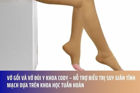 Vớ Gối và Vớ Đùi Y Khoa Cody – Hỗ Trợ Điều Trị Suy Giãn Tĩnh Mạch Dựa Trên Khoa Học Tuần Hoàn