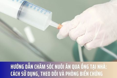 Hướng dẫn chăm sóc nuôi ăn qua ống tại nhà: Cách sử dụng, theo dõi và phòng biến chứng