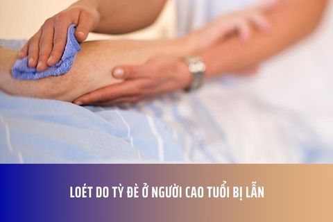 Loét do tỳ đè ở người cao tuổi bị lẫn