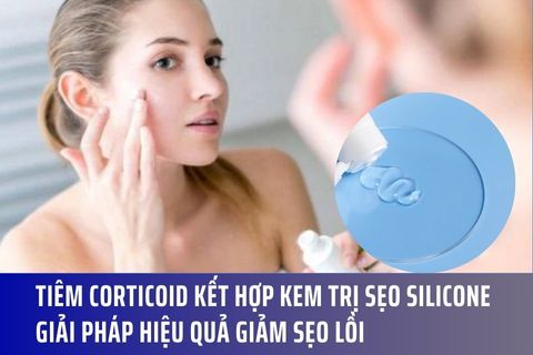 Tiêm Corticoid Kết Hợp Kem trị sẹo Silicone – Giải Pháp Hiệu Quả Giảm Sẹo Lồi