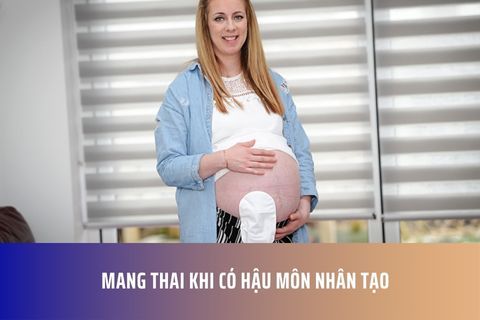 Mang Thai Khi Có Hậu Môn Nhân Tạo