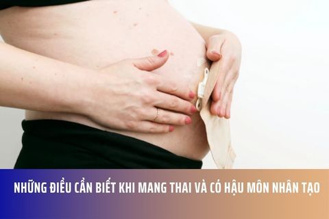 Những điều cần biết khi mang thai và có hậu môn nhân tạo