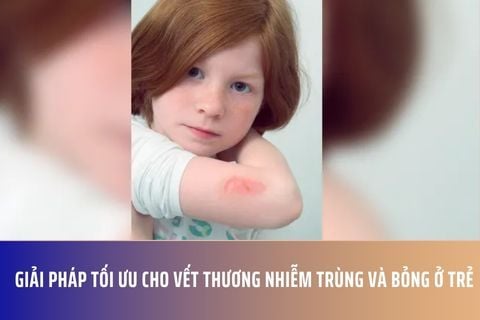 Giải Pháp Tối Ưu Cho Vết Thương Nhiễm Trùng Và Bỏng Ở Trẻ