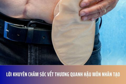 Lời khuyên chăm sóc vết thương quanh hậu môn nhân tạo
