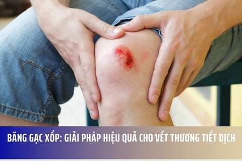 Băng Gạc Xốp: Giải Pháp Hiệu Quả Cho Vết Thương Tiết Dịch