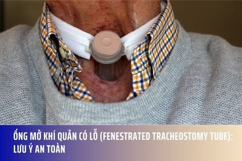 Ống Mở Khí Quản Có Lỗ (Fenestrated Tracheostomy Tube): Lưu Ý An Toàn