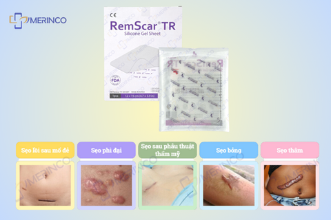 Các câu hỏi thường gặp về Miếng dán ép sẹo RemScar® TR (Phần 1)