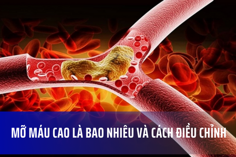 Mỡ máu cao là bao nhiêu và cách điều chỉnh