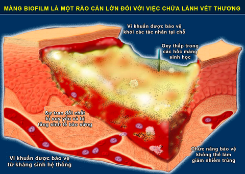 Phẫu thuật cắt lọc vết thương