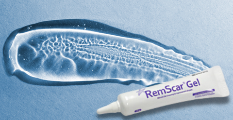 Tại sao nên sử dụng kem trị sẹo silicon sau phẫu thuật laser loại bỏ sẹo?