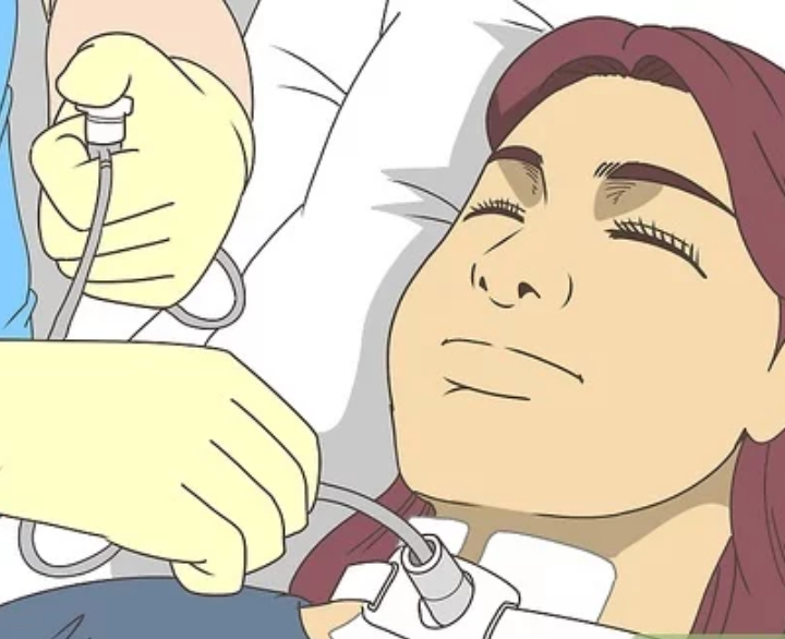 Hút dịch đờm khí quản: Hút đờm khí quản là gì và cách thực hiện và vệ ...
