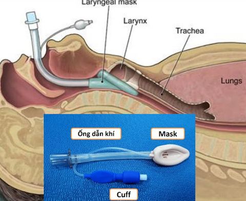 Tìm hiểu thêm về Mask Thanh Quản