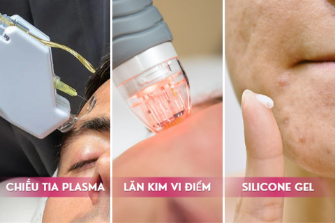 3 phương pháp trị sẹo mụn hiệu quả: Chiếu tia plasma, Lăn kim vi điểm, và Silicone gel