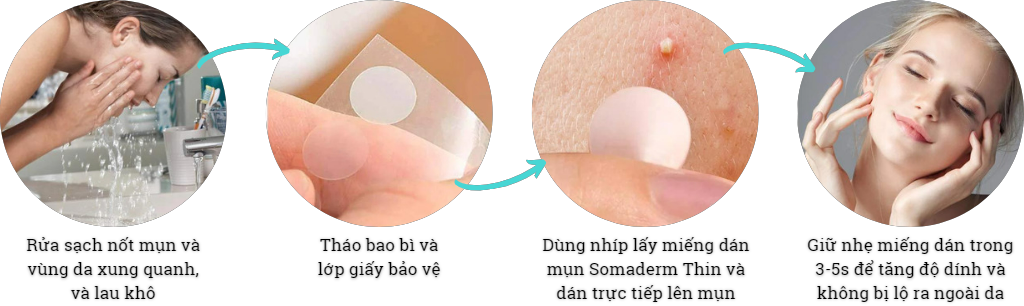 Miếng dán mụn Somaderm-Thin giảm hình thành sẹo loại mỏng (24 miếng)