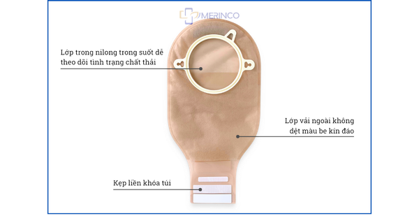 Tìm hiểu về các loại hệ thống túi hậu môn nhân tạo