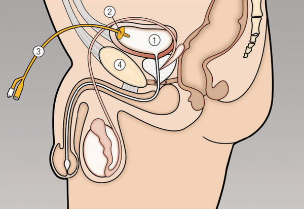 Những lưu ý quan trọng khi thực hiện phẫu thuật