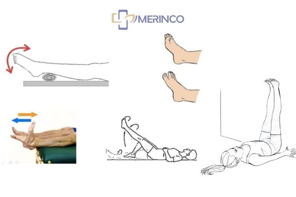 Suy giãn tĩnh mạch mạn tính có được tập thể dục không?