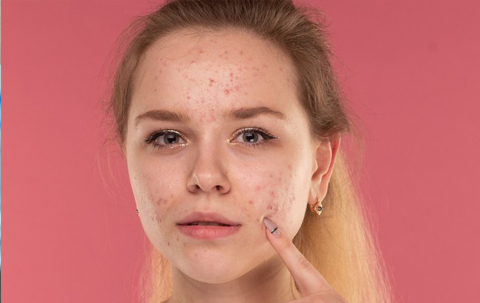 Kem Trộn Trắng Da Thần Tốc - Con Dao Hai Lưỡi Với Làn Da Của Bạn