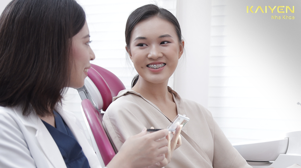 NIỀNG RĂNG CỬA MẤT BAO LÂU? CÓ HIỆU QUẢ KHÔNG?