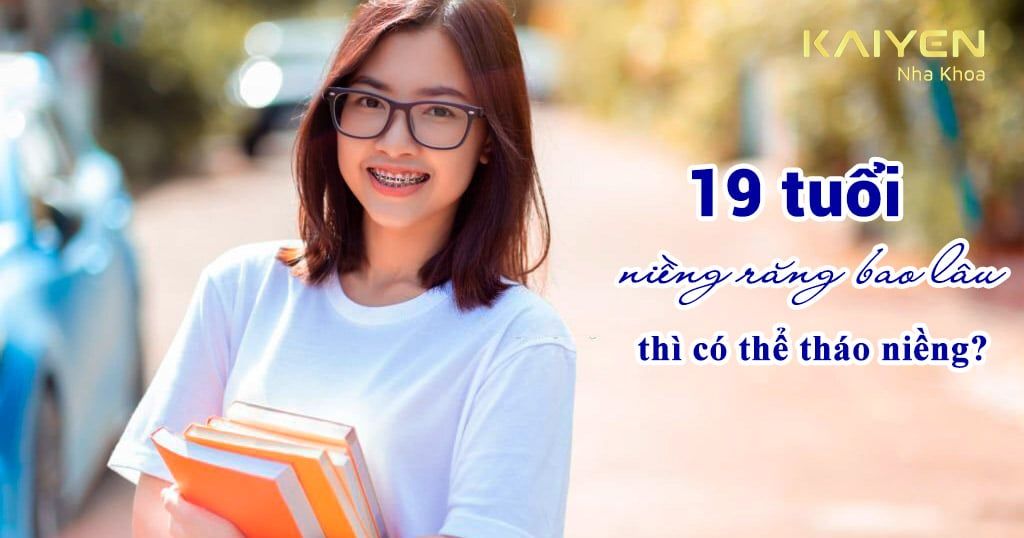 19 tuổi niềng răng bao lâu thì tháo niềng? Giá bao nhiêu?
