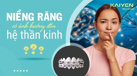 Sự thật tin đồn niềng răng dễ bị “khùng”