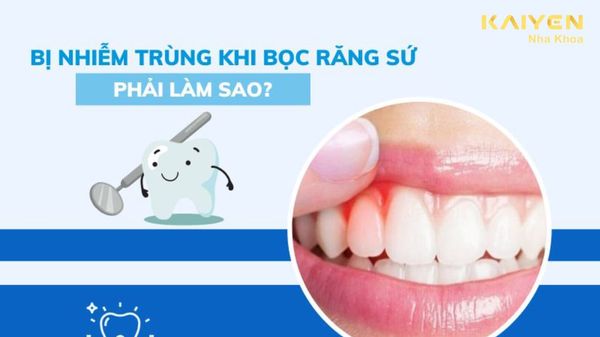 Bị nhiễm trùng khi bọc răng sứ phải làm sao?