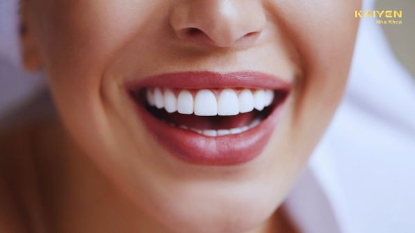 Bọc Răng Sứ Tại Quận 2 - Thảo Điền - Khu Dân Cư Estella - Khu Đô Thị Sala