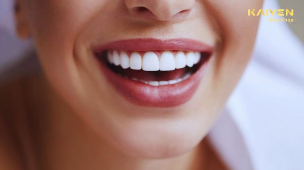 Bọc răng sứ vĩnh viễn có được không? Độ bền phụ thuộc vào điều gì?