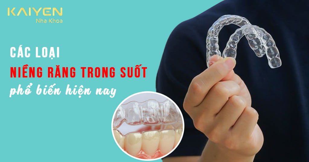 Các loại niềng răng trong suốt phổ biến hiện nay, loại nào tốt?