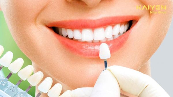 Cách Chăm Sóc Và Vệ Sinh Răng Sứ Bền Lâu