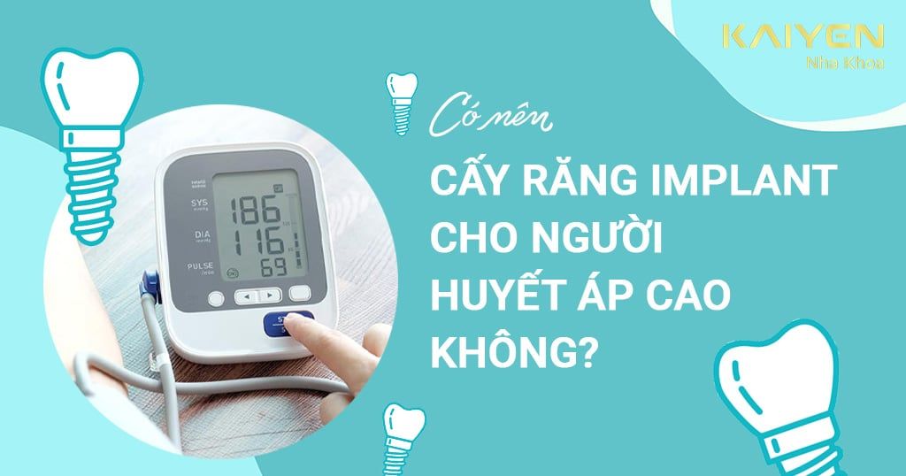 Cấy ghép Implant cho người cao huyết áp được không? Giải pháp an toàn