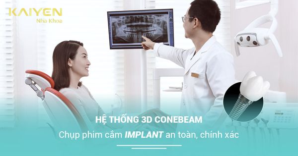Hệ thống 3D ConeBeam: Chụp phim cắm Implant an toàn, chính xác