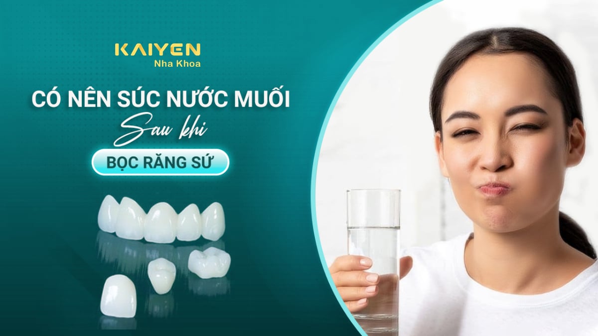 Có%20nên%20súc%20nước%20muối%20sau%20khi%20bọc%20răng%20sứ%20không?%20–%20Nha%20khoa%20Quốc%20Tế%20KAIYEN