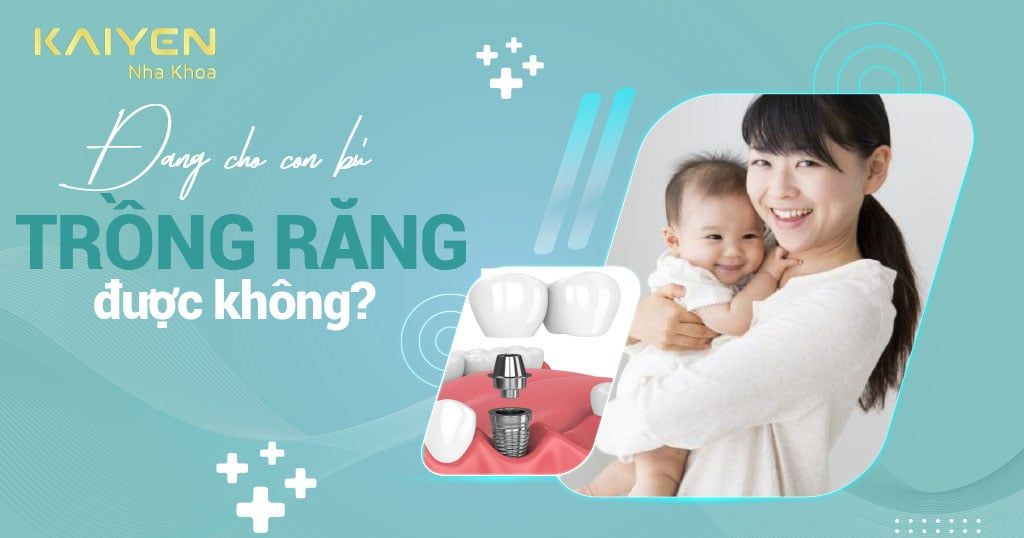[GIẢI ĐÁP] Phụ nữ đang cho con bú có trồng răng được không?