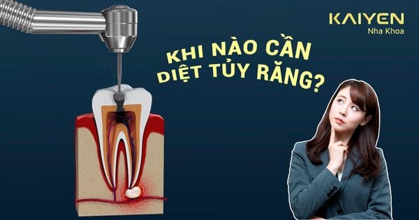 Khi nào cần diệt tủy răng? Đặt thuốc diệt tủy có đau không?